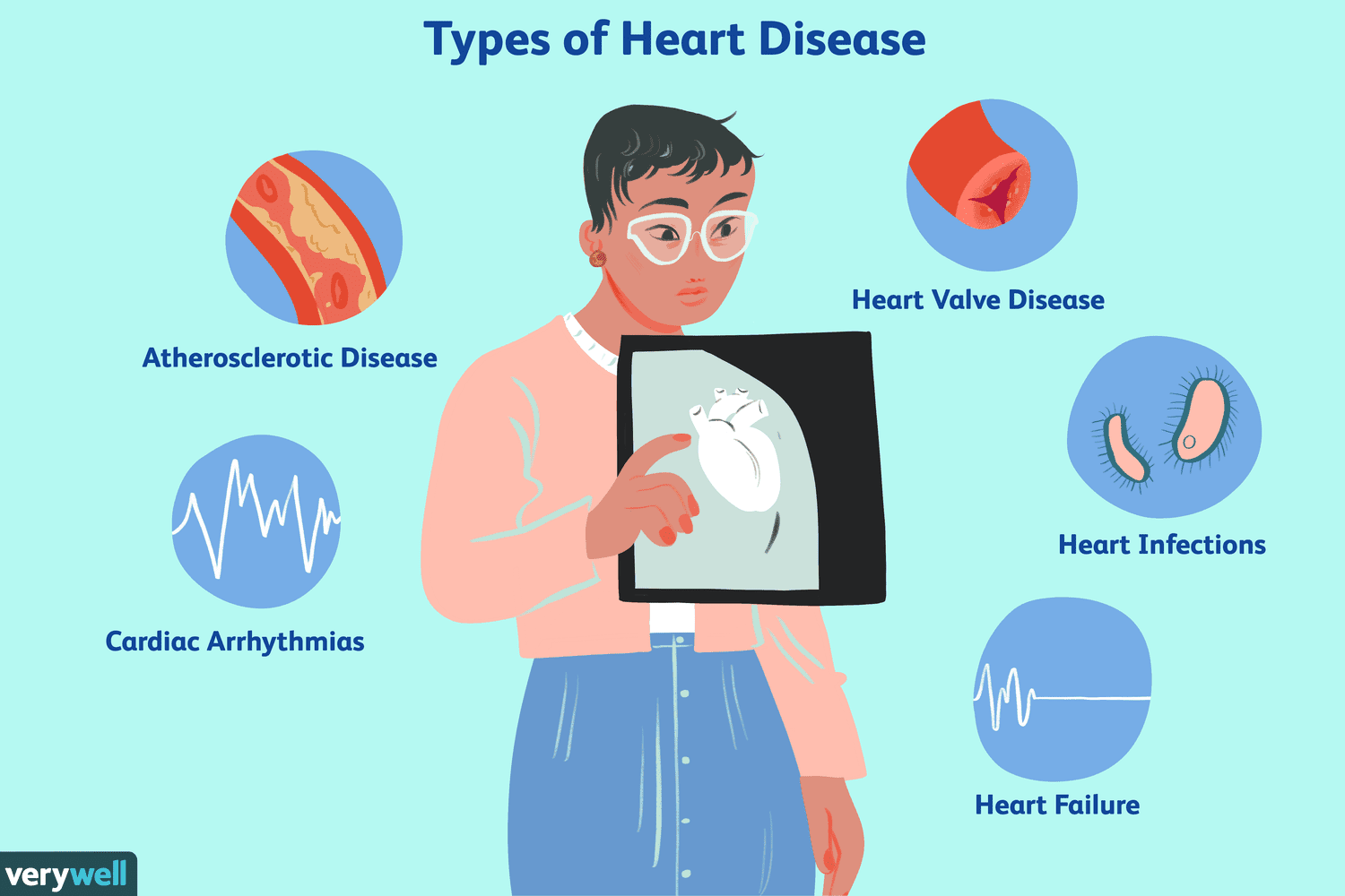overview-of-heart-disease-